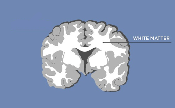 Mati Re Grise Vs Substance Blanche Dans Le Cerveau Adam Faliq   Brain   White Matter 